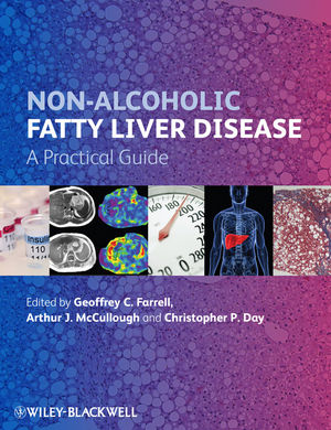Non-Alcoholic Fatty Liver Disease: A Practical Guide 2013