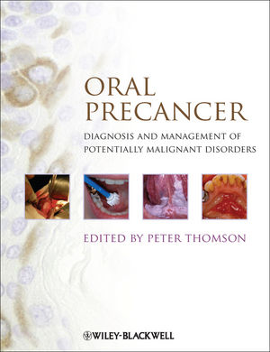 Oral Precancer: Diagnosis and Management of Potentially Malignant Disorders 2012