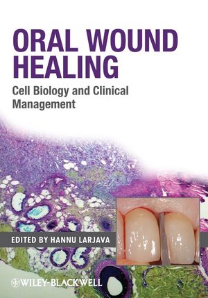 Oral Wound Healing: Cell Biology and Clinical Management 2012