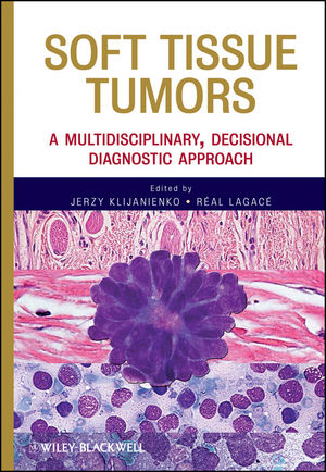 Soft Tissue Tumors: A Multidisciplinary, Decisional Diagnostic Approach 2011