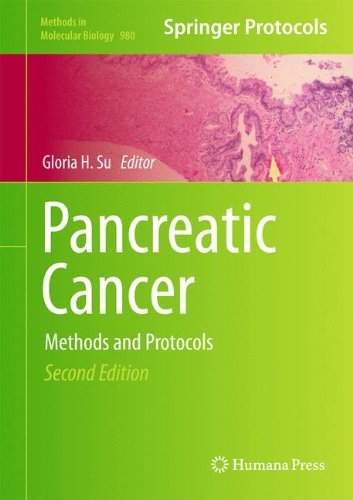 Pancreatic Cancer: Methods and Protocols 2013