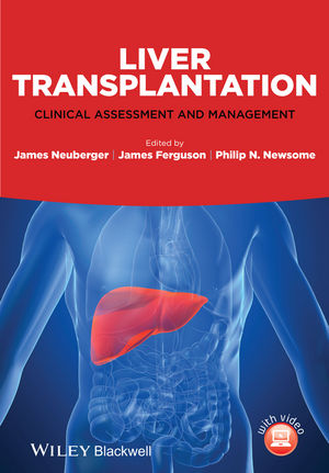 Liver Transplantation: Clinical Assessment and Management 2013