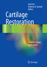 Cartilage Restoration: Practical Clinical Applications 2013