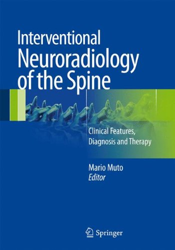 Interventional Neuroradiology of the Spine: Clinical Features, Diagnosis and Therapy 2012