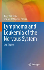 Lymphoma and Leukemia of the Nervous System 2011