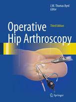 Operative Hip Arthroscopy 2012