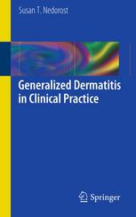 Generalized Dermatitis in Clinical Practice 2012
