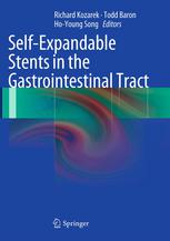 Self-Expandable Stents in the Gastrointestinal Tract 2012
