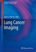 Lung Cancer Imaging 2013
