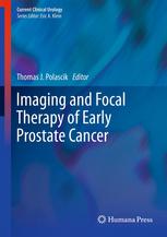 Imaging and Focal Therapy of Early Prostate Cancer 2012