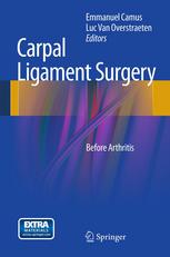 Carpal Ligament Surgery: Before Arthritis 2013