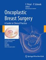 Oncoplastic Breast Surgery: A Guide to Clinical Practice 2010