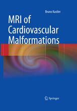 MRI of Cardiovascular Malformations 2010