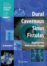 Dural Cavernous Sinus Fistulas: Diagnosis and Endovascular Therapy 2009