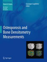 Osteoporosis and Bone Densitometry Measurements 2013