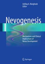 نیووژنز: مکانیسم ها و پیامدهای بالینی پیشرفت خال