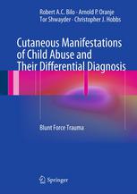 Cutaneous Manifestations of Child Abuse and Their Differential Diagnosis: Blunt Force Trauma 2012
