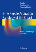 Fine Needle Aspiration Cytology of the Breast: Atlas of Cyto-Histologic Correlates 2013