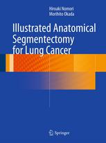 Illustrated Anatomical Segmentectomy for Lung Cancer 2013