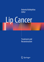 Lip Cancer: Treatment and Reconstruction 2013