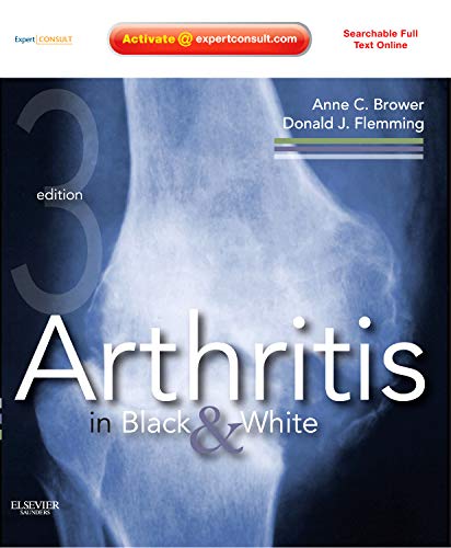 Arthritis in Black and White: Expert Consult - Online and Print 2012