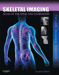 Skeletal Imaging: Atlas of the Spine and Extremities 2010