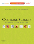 Cartilage Surgery: An Operative Manual 2011
