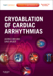 Cryoablation of Cardiac Arrhythmias 2011