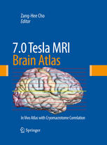 7.0 Tesla MRI Brain Atlas: In Vivo Atlas with Cryomacrotome Correlation 2009