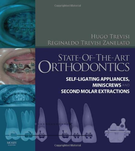 State-of-the-art Orthodontics: Self-ligating Appliances, Miniscrews and Second Molar Extractions 2011