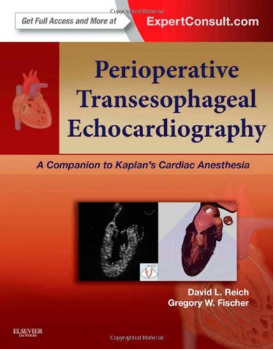 Perioperative Transesophageal Echocardiography: A Companion to Kaplan's Cardiac Anesthesia (Expert Consult: Online and Print) 2013