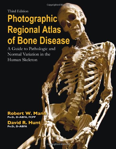 اطلس عکاسی منطقه ای بیماری استخوان: راهنمای تغییرات پاتولوژیک و طبیعی در سیستم اسکلتی انسان