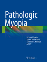 Pathologic Myopia 2013