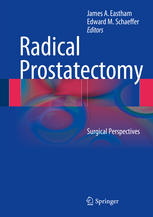 Radical Prostatectomy: Surgical Perspectives 2013