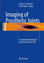 Imaging of Prosthetic Joints: A Combined Radiological and Clinical Perspective 2013