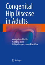 Congenital Hip Disease in Adults 2013