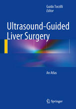 Ultrasound-Guided Liver Surgery: An Atlas 2014