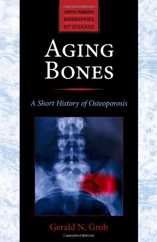 Aging Bones: A Short History of Osteoporosis 2014