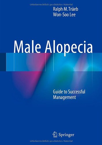Male Alopecia: Guide to Successful Management 2014