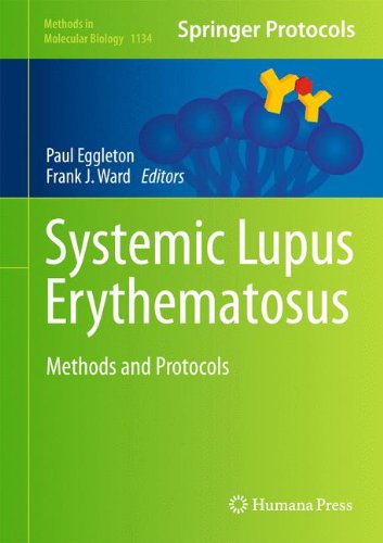 Systemic Lupus Erythematosus: Methods and Protocols 2014