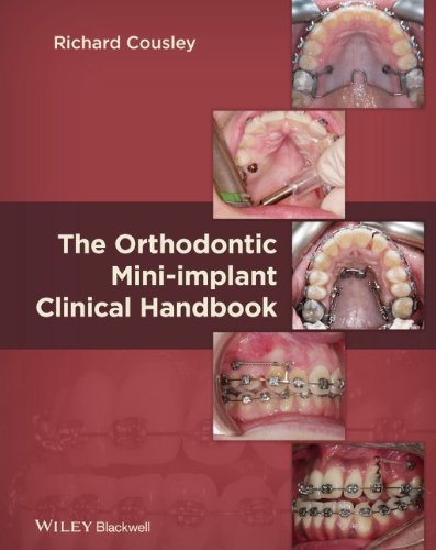 The Orthodontic Mini-implant Clinical Handbook 2013