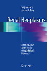 Renal Neoplasms: An Integrative Approach To Cytopathologic Diagnosis 2014
