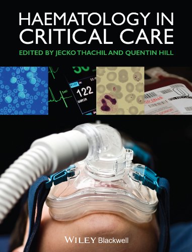Haematology in Critical Care: A Practical Handbook 2014