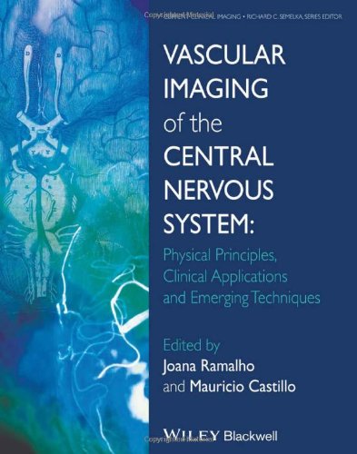 Vascular Imaging of the Central Nervous System: Physical Principles, Clinical Applications, and Emerging Techniques 2014