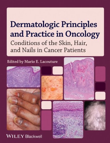 Dermatologic Principles and Practice in Oncology: Conditions of the Skin, Hair, and Nails in Cancer Patients 2014