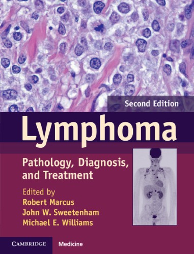Lymphoma: Pathology, Diagnosis, and Treatment 2013