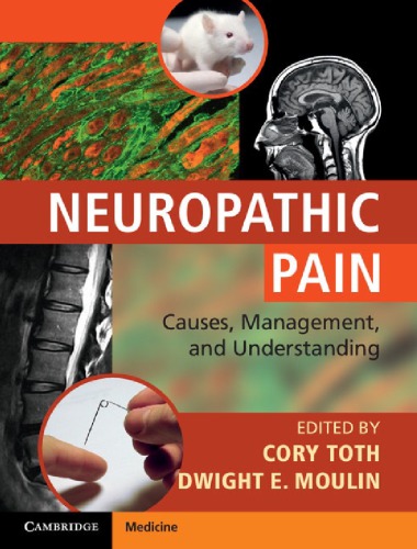 Neuropathic Pain: Causes, Management and Understanding 2013