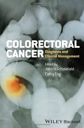 Colorectal Cancer: Diagnosis and Clinical Management 2014