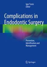 Complications in Endodontic Surgery: Prevention, Identification and Management 2014