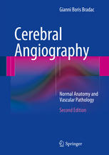 Cerebral Angiography: Normal Anatomy and Vascular Pathology 2014